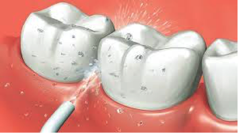 Irrigador bucal online para implantes