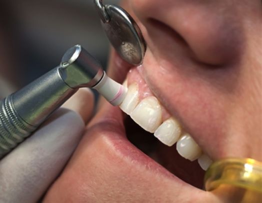 periodoncia opt n 2