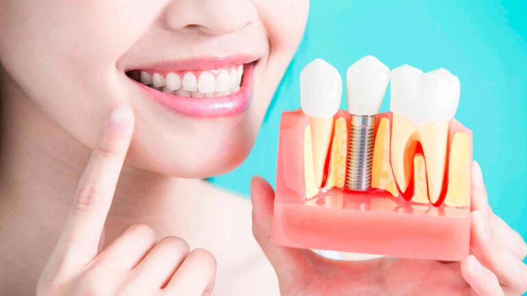 endodoncia 4
