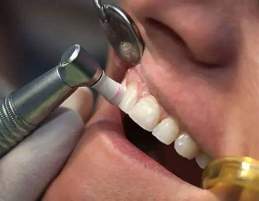 periodoncia-madrid-1