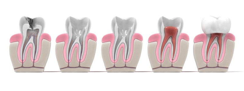 fotolia 109384035 s