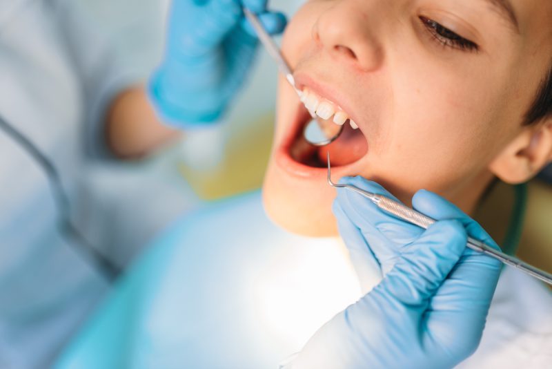 Little boy with open mouth in a dental cabinet, pediatric dentistry. Female dentist looking for caries