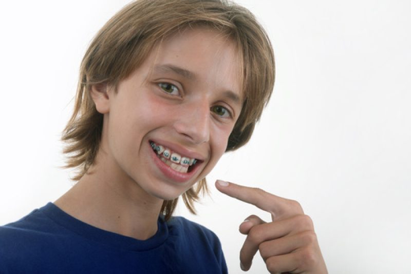 Orthodontie - Enfant montrant ses bagues 02