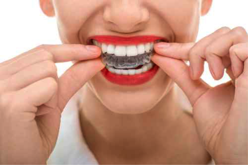 invisalign ciudad lineal