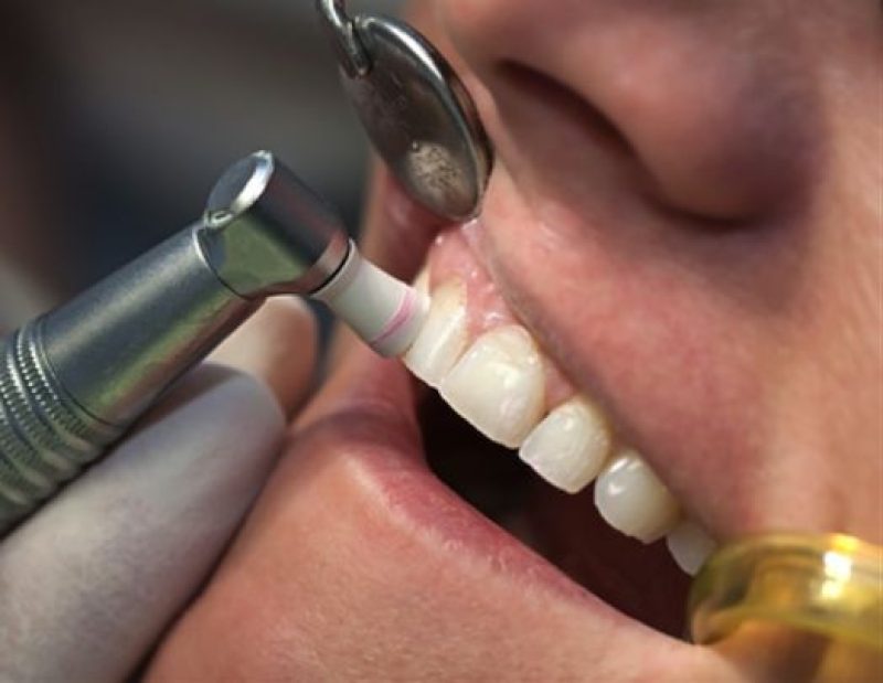 periodoncia opt n 2
